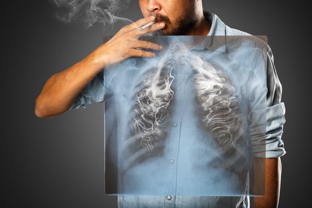 suitsetamine mõjutab kahjulikult inimese keha